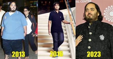 Anant Ambani's Battle with the Disorder: Insights and Impact