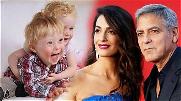 Does George Clooney's Child Have Down Syndrome?