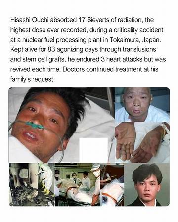 The Tragic "Hisashi Ouchi Case": a Lesson in Nuclear Disaster Management